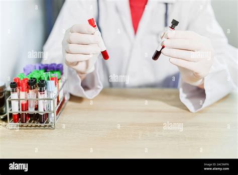 laboratory equipment for blood testing